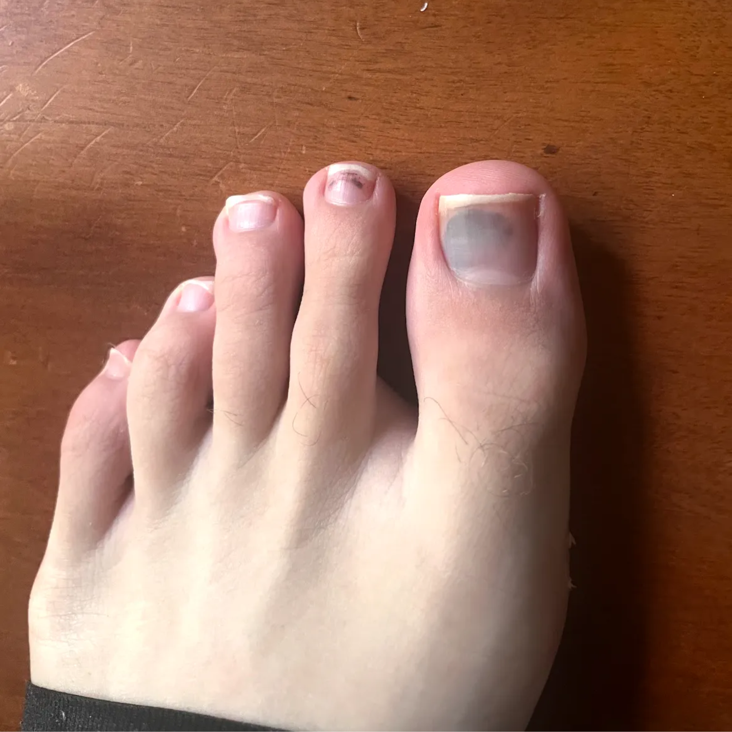 jack pearson marathon toe